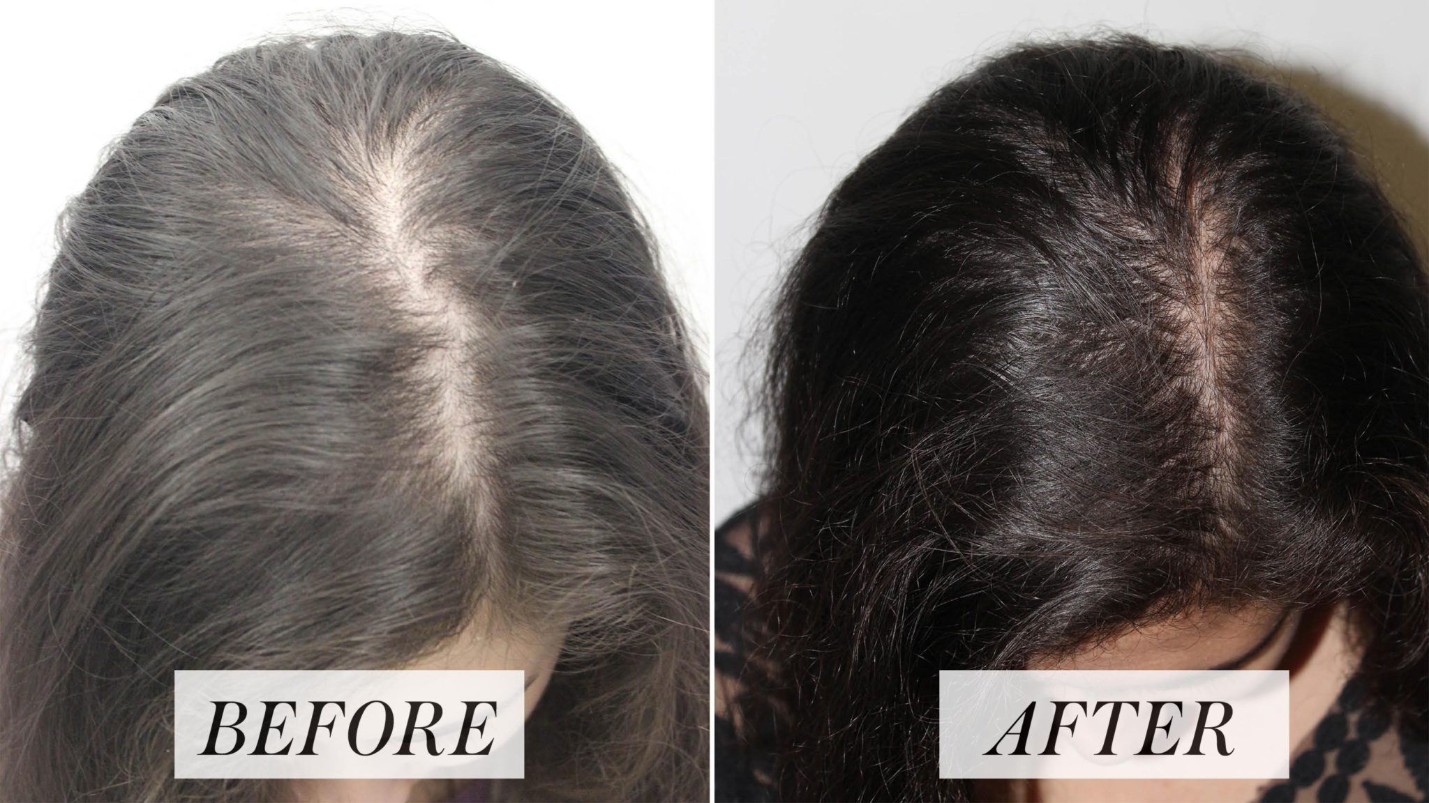 Hair Growth Remedies