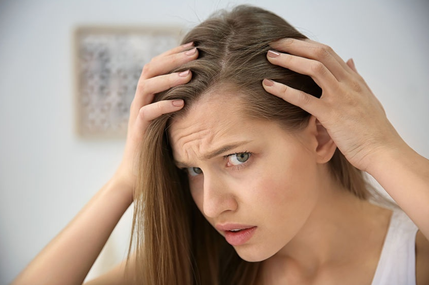 Alopecia in women